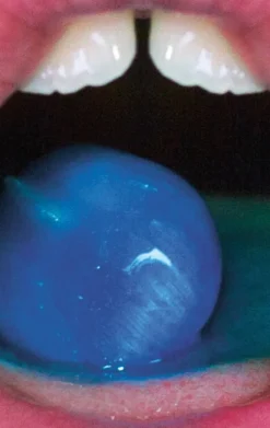 Kehrer Verlag Jag var ett äpple och jag skalades men det var en bra sak